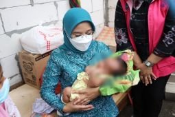 Pemkot Surabaya dan Baznas kolaborasi tangani anak stunting