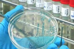 Kasus flu burung baru terdeteksi, Australia waspada penuh